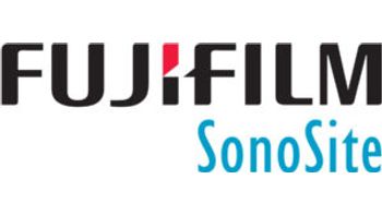 SONOSITE